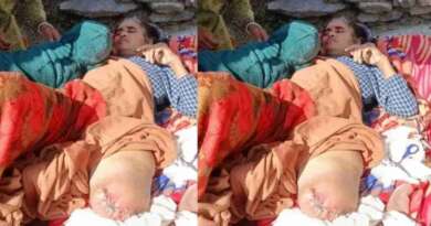 पिथौरागढ़ : सिस्टम की लापरवाही के कारण निर्मला देवी हुई अपाहिज…