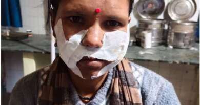 लोहाघाट : जंगल गई महिला पर गुलदार का हमला, बाल बाल बची जान