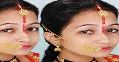 हल्द्वानी : गर्दन के दर्द का इलाज कराने गई 24 वर्षीय महिला की मौत, मालिश के बाद गर्दन झटकने का आरोप