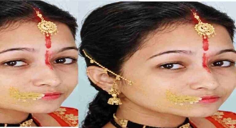 हल्द्वानी : गर्दन के दर्द का इलाज कराने गई 24 वर्षीय महिला की मौत, मालिश के बाद गर्दन झटकने का आरोप